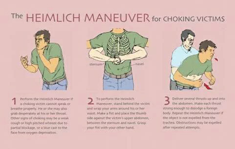 Orang Yg Tersedak Makan Ayam Ga Akan Meninggal Klo Kita Mengenal Heimlich Manuver