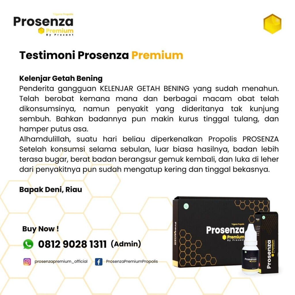 https://s.kaskus.id/images/2023/03/09/11355574_20230309111702.jpg