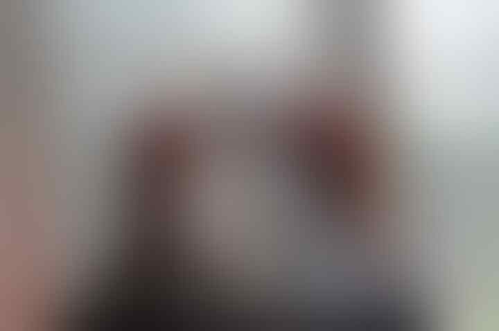 ' Oogy' ANJING JELEK DENGAN WAJAH SEPARUH YANG HANCUR !! (+PIC)