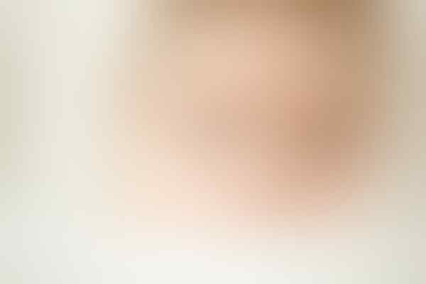 Mengenal Katarak Kongenital Pada Bayi