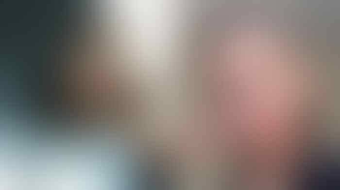 Sebar Pesan Positif Tentang Inner Beauty Melalui Gadis berjerawat Ini