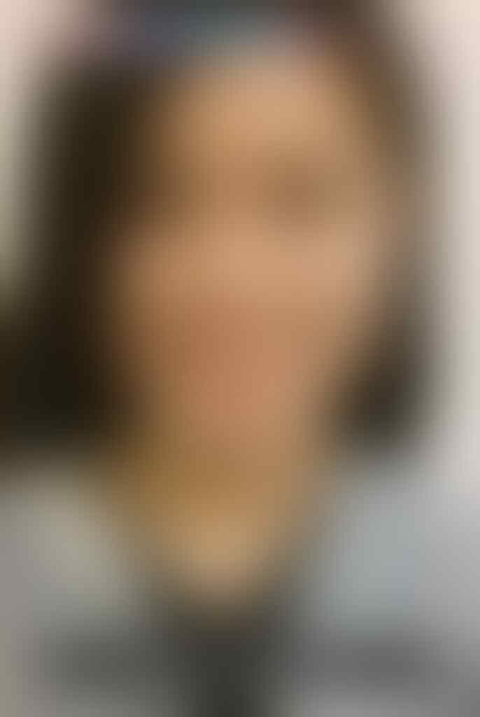 Wanita Ini Rela Oplas Wajah & BOOBS Demi Sang Kekasih, Hasilnya ?? * 30x oplas gan!
