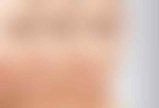 Buah Murah Meriah dan Kaya Manfaat Buat Si Pengidap Hipertensi