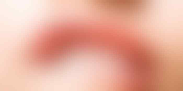 Kupas Tuntas Misteri 'Obat Tetes Mata Dicampur Soda' Ternyata Berbahaya! (Khusus 18+)