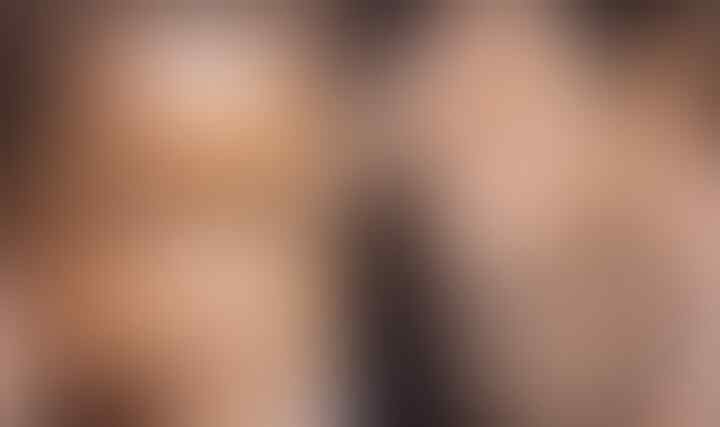 Perlunya Penguatan Edukasi tentang Cacar Monyet