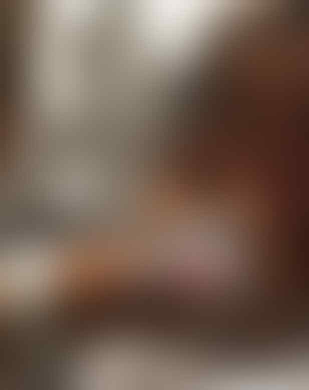 OMG, Vibrator Tersangkut Karena Semangat Kimpoi, Wanita Muda Ini Harus di Operasi