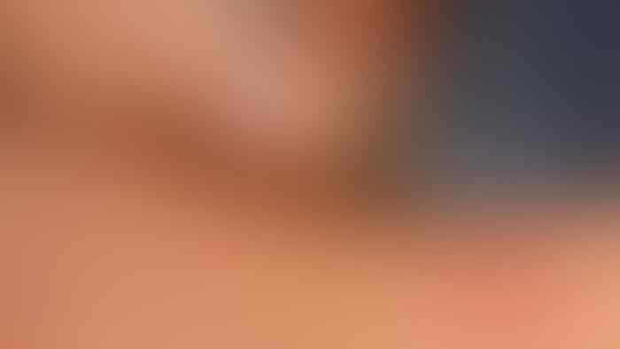 Dari Bengkak Hingga Kematian, Inilah Bahaya Sengatan Lebah Bagi Manusia