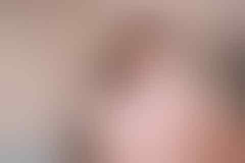 25 Tahun Baru Kembali, Setelah Kabur Takut Sunat! Pentingnya Jangan Nakutin Anak