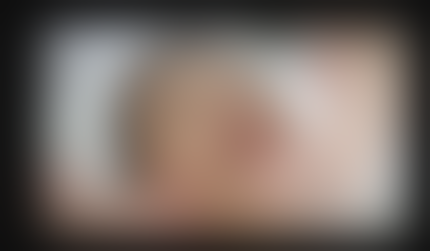 Mengenal Facial Vampir, Penyebab 3 Wanita Didiagnosa HIV