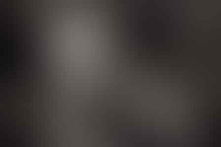 Mengenal Tradisi di Ethiopia, Semakin Lebar Bibir Wanita Semakin Dianggap Cantik