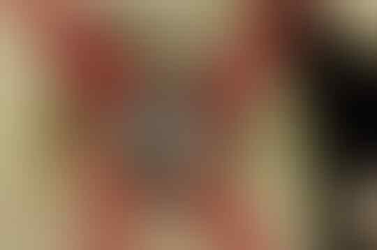 Jenis Phobia "Rasa Takut" Yang Bisa Membunuhmu