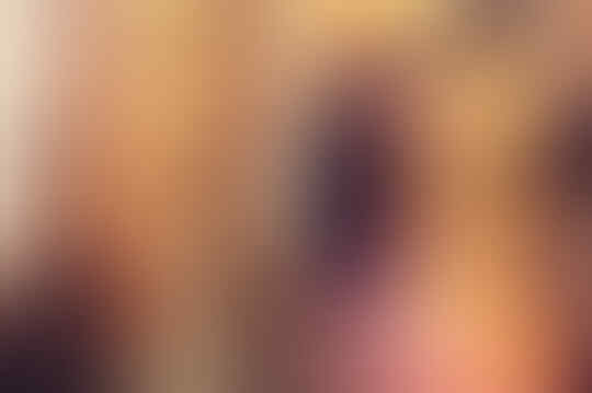 Bokong Meledak, Bintang Porno Ini Ganti Implan Pinggulnya