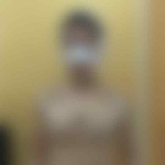 Gini Nih Proses Oplas Remaja Pria Jadi Perempuan, Hasilnya Mengejutkanš„