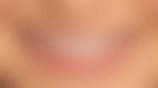 Memakai Behel Itu Alay? Yuk Ikuti Tips Berikut agar Behel tak Menjadi Perusak