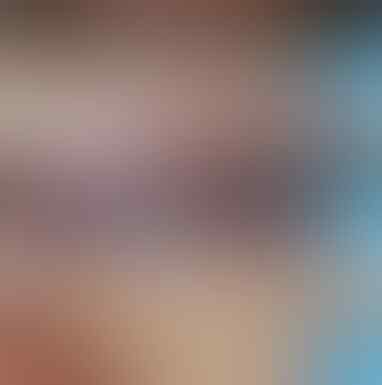 Memakai Behel Itu Alay? Yuk Ikuti Tips Berikut agar Behel tak Menjadi Perusak