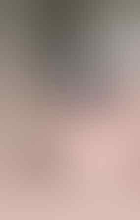 Wanita Ini Tidak Bisa Melihat Akibat Softlens. Sista Wajib Hati-Hati!