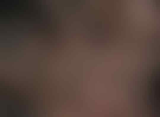 Deretan Hewan Penyembuh Penyakit, Ada Yang Menjijikkan Dan Ada Yang Berharga Milyaran