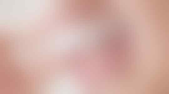Clear Aligner, Inovasi Kawat Gigi Terkini