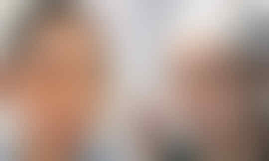 Potret Wajah Perawat Virus Corona China, Wajah Lebam Membiru karena Masker