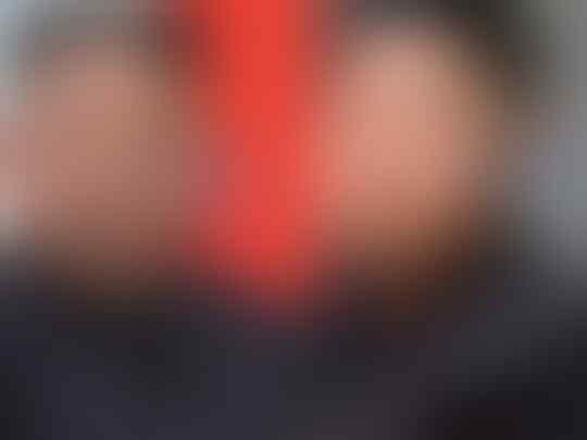 Jangan Senang Dulu, Kim Jong-Un yang Baru Muncul ke Publik Disinyalir Palsu!