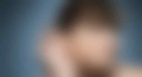 Waspada, Ditemukan 3 Gejala Baru Efek Samping Bagi 'Mantan' Penderita Covid-19