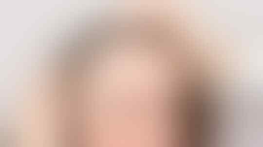 Cara Alami Yang Ampuh Menghilangkan Rambut Uban Di Usia Muda