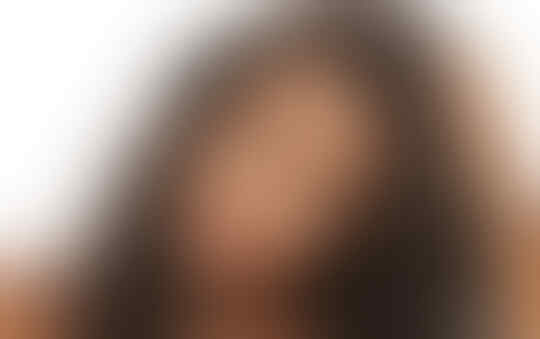 Menghilangkan Ketombe Ternyata Bisa Dilakukan Dengan 8 Cara Mudah Ini