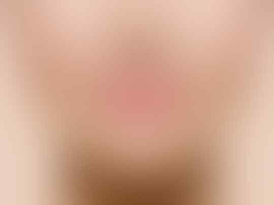 5 Bahan Alami Ini Bisa Bantu Atasi Bibir Gelap, Lho! Yuk, Coba!