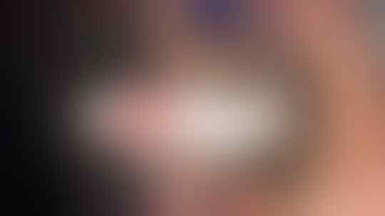 Heboh Foto Penampakan Hewan 'BERKAKI 6' Yang Bikin Penasaran !
