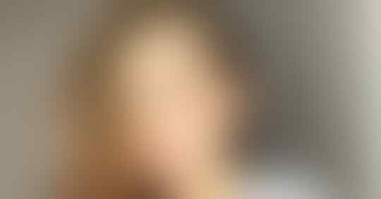 Walau Sudah Memiliki Buah Hati, 5 Seleb Wanita Ini Masih Seperti Remaja Gansis!