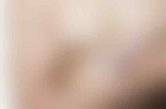Tragis! Over Dosis Steroid, Tampilan Binaragawati Ini Jadi Mengerikan!