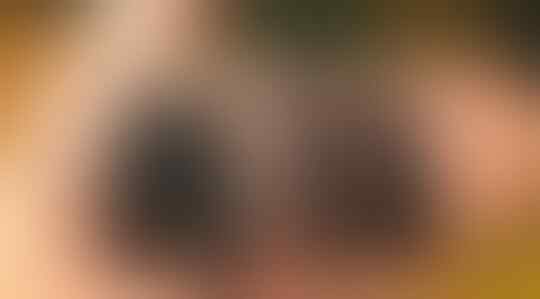 Serangga Paling Mematikan di Dunia! Ada Lalat Juga Lho Ternyata
