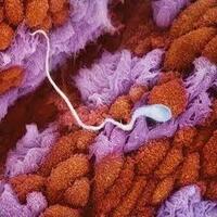 penasaran-foto-perubahan-sperma-menjadi-janin