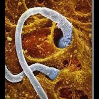 penasaran-foto-perubahan-sperma-menjadi-janin