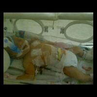 help-baby-diego-lim-sakit-jadi-johnson-lim-keracunan-ketuban-dan-paru2-nya-kena