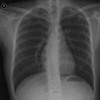 tolong-baca-hasil-rontgen-ane-gan