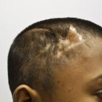 kisah-mengharukan-seorang-anak-yang-selamat-dari-serangan-brutal