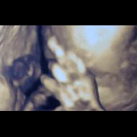 foto-bayi-dalam-kandungan-acungkan-jari-tengah