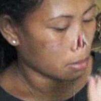 lagiwni-mengalami-penyiksaan