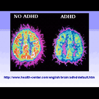 bocah-ajaib-----einsten-lewat