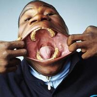 apa-yang-agan-lakukan-kalo-punya-mulut-seperti-ini