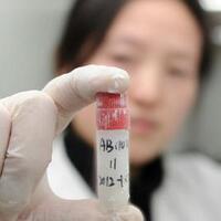 pendonor-sperma-di-china-dibayar-rp-95-juta