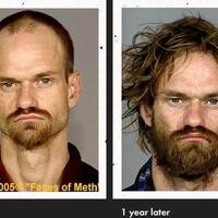 wajah-pengguna-narkoba-sebelum--sesudah-jadi-pecandu