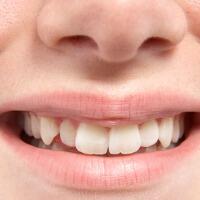 apa-pendapat-agan---aganwati-kalo-cowok-berginsul