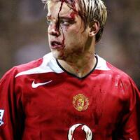 10-pebola-paling-tangguh-saat-terkena-cedera