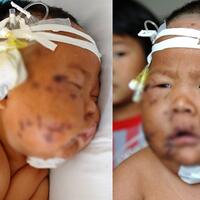 miris-menggigit-saat-disusui-bayi-ditusuk-gunting-90-kali-oleh-ibunya