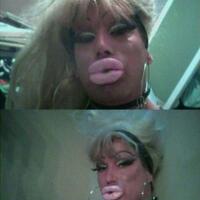 tips-mengecilkan-pipi