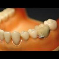 wi-fi-gigi-untuk-kontrol-makan