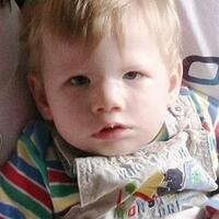 kisah-manusia-tanpa-ekspresi-terlahir-tanpa-bisa-tersenyum