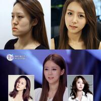 diejek-wanita-ini-operasi-wajah-mirip-yoona--snsd